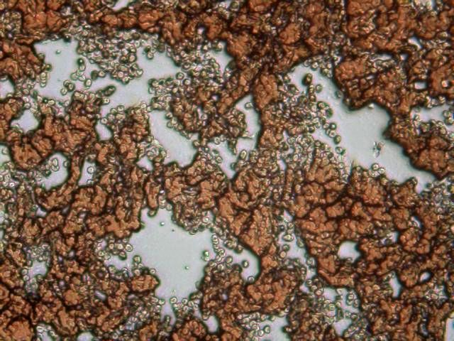 Anti-aging (anti-age). El test de sangre HLB puede valorar si estamos envejeciendo antes de tiempo